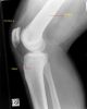 X-ray knee