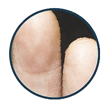 no fingerprint