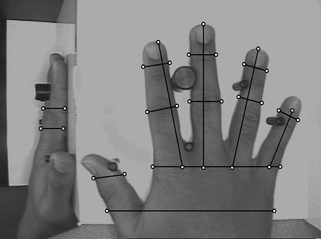hand features