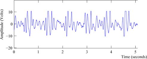 Signal from sensor at 40cm from the chest of a seated subject