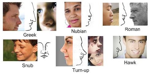 nose types